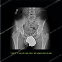 Image - What's the Diagnosis Case 181 thumbnail
