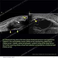 Image - Ultrasound of the Month Case 57 thumbnail
