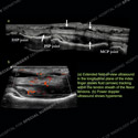 Image - Ultrasound Case 139 thumbnail