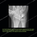 Image - Ultrasound Case 144 thumbnail