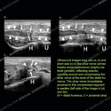 Image - Ultrasound Case 147 thumbnail