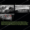 Image - Ultrasound Case 151 thumbnail
