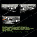 Image - Ultrasound Case 154 thumbnail