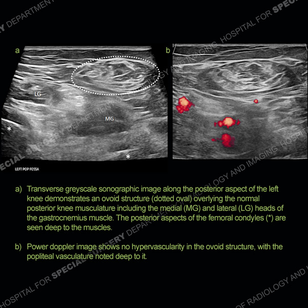 Ultrasound Case 162