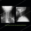 Image - What's the Diagnosis Case 154 thumbnail