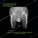 Image - What's the Diagnosis Case 171 thumbnail