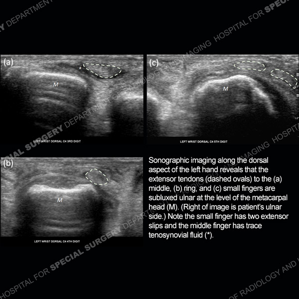Ultrasound Case 183