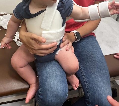An infant wearing a teapot splint.