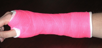 Distal Radius Fractures of the Wrist: Avoiding Complications with