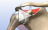Graphic: Shoulder arthroscopy animation