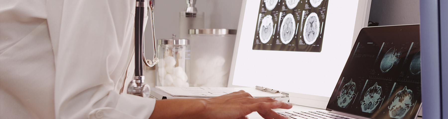 Banner image of a physician reviewing brain scans