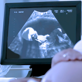 Image of a pregnancy sonogram.