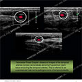 Image - Ultrasound of the Month Case 44 thumbnail