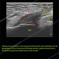 Image - Ultrasound of the Month Case 50 thumbnail