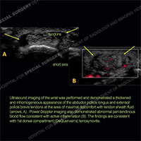 Image - Ultrasound of the Month Case 54 thumbnail
