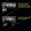 Image - Ultrasound of the Month Case 66 thumbnail