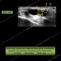 Image - Ultrasound of the Month Case 26 thumbnail