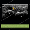 Image - Ultrasound of the Month Case 45 thumbnail