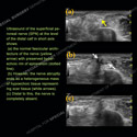 Image - Ultrasound of the Month Case 63 thumbnail