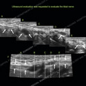 Image - Ultrasound Case 107 thumbnail
