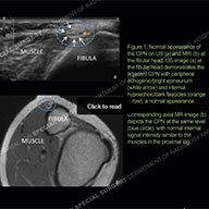 Image - Ultrasound of the Month Case 56 thumbnail