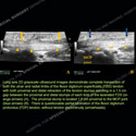 Image - Ultrasound of the Month Case 88 thumbnail