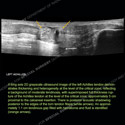 Image - Ultrasound of the Month Case 91 thumbnail