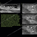 Image - Ultrasound Case 118 thumbnail