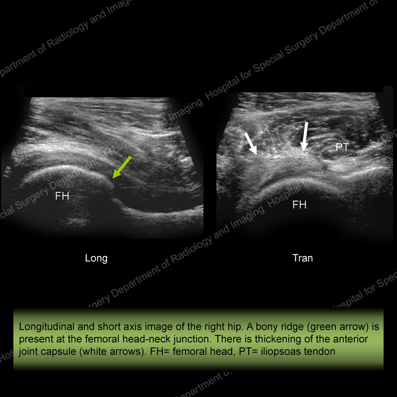 Ultrasound of the Month Case 10 - slide 1