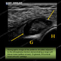 Image - Ultrasound of the Month Case 21 thumbnail
