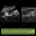 Image - Ultrasound of the Month Case 7 thumbnail