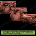 Image - Ultrasound of the Month Case 8 thumbnail