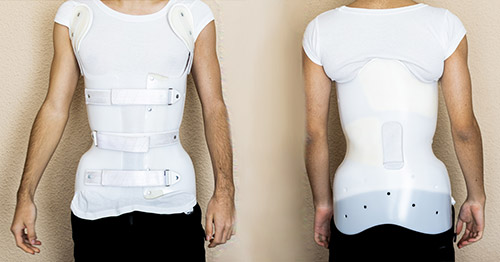 image of patient wearing scoliosis brace