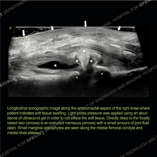Ultrasound Case 163