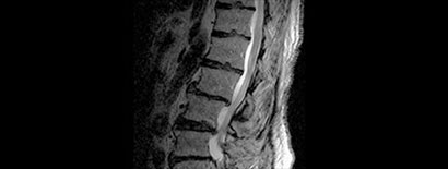 Image - Integrated Spine Research