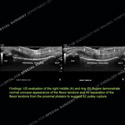 Image - Ultrasound of the Month Case 64 thumbnail
