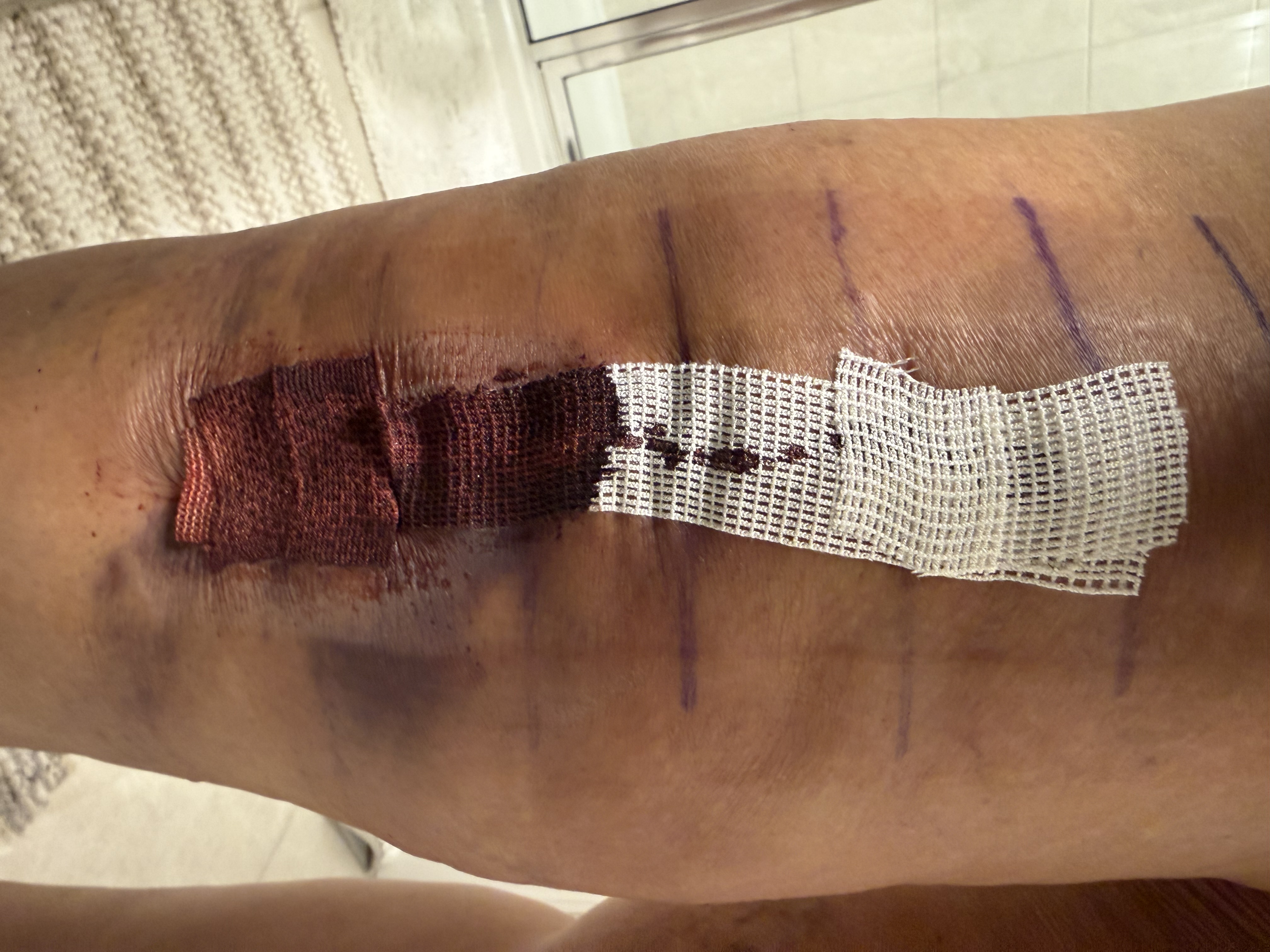 Patient image of: Roslyn Robinson