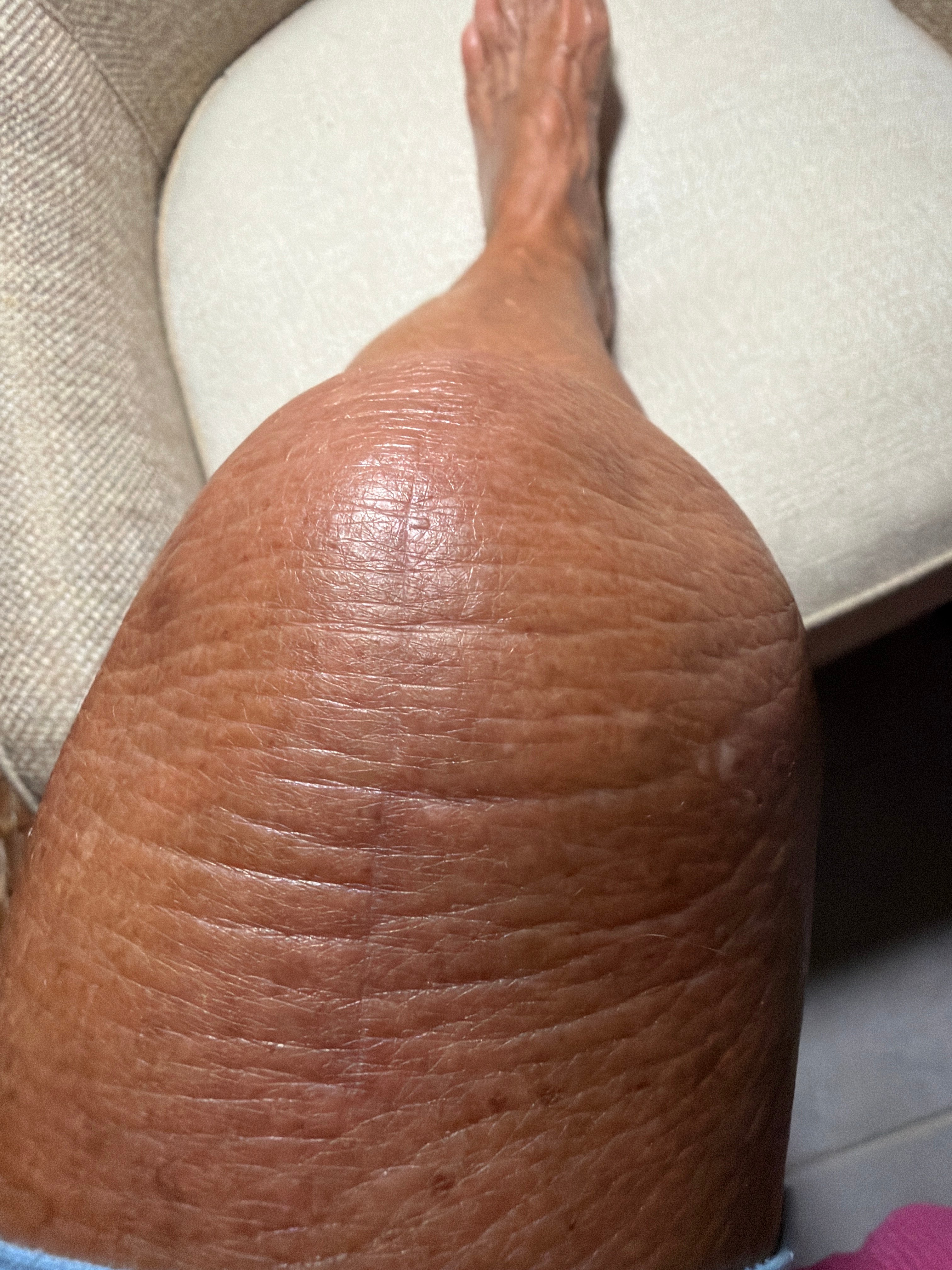 Patient image of: Colleen White