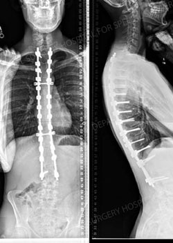Post operative x-ray images