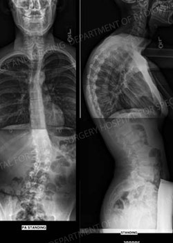 Pre-Operative x-ray images