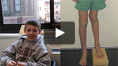 Limb Lengthening - Bobby's Story Video