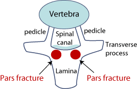 Illustration: Top view of the spinal column