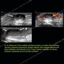Image - Ultrasound Case 120 thumbnail