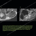 Image - Ultrasound Case 121 thumbnail