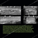 Image - Ultrasound Case 122 thumbnail