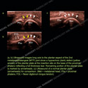 Image - Ultrasound Case 123 thumbnail