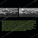 Image - Ultrasound Case 124 thumbnail