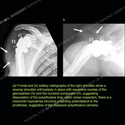 Image - Ultrasound Case 125 thumbnail