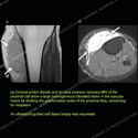 Image - Ultrasound Case 126 thumbnail