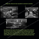 Image - Ultrasound Case 127 thumbnail